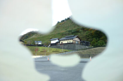 緑内障は治る？そもそも「緑内障」とは？